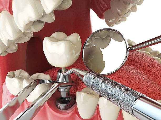 Professional Emergency Dental Service in AK
